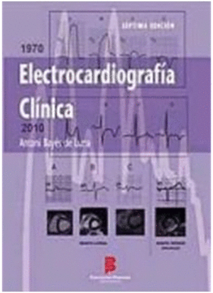 ELECTROCARDIOGRAFIA CLINICA