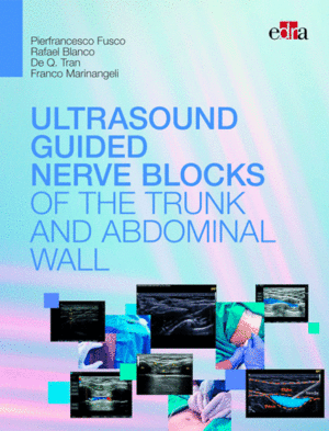 ULTRASOUND-GUIDED NERVE BLOCKS OF THE TRUNK AND ABDOMINAL WALL