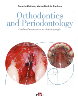 ORTHODONTICS AND PERIODONTOLOGY. COMBINED TREATMENTS AND CLINICAL SYNERGIES