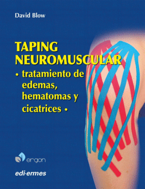 TAPING NEUROMUSCULAR. TRATAMIENTO DE EDEMAS, HEMATOMAS Y CICATRICES