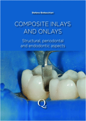 COMPOSITE INLAYS AND ONLAYS. STRUCTURAL, PERIODONTAL, AND ENDODONTIC ASPECTS