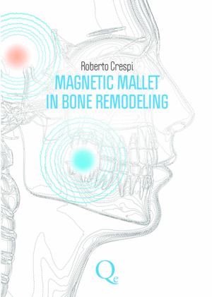 MAGNETIC MALLET IN BONE REMODELING