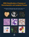 WHO CLASSIFICATION OF TUMOURS OF HAEMATOPOIETIC AND LYMPHOID TISSUES