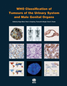 WHO CLASSIFICATION OF TUMOURS OF THE URINARY SYSTEM AND MALE GENITAL ORGANS. 4TH ED. VOLUME 8