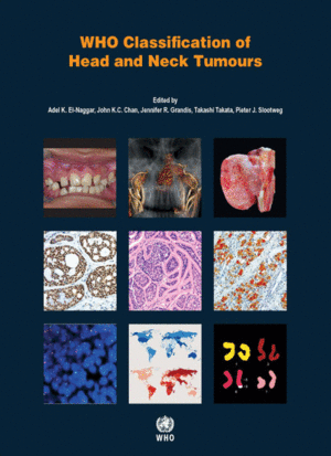 WHO CLASSIFICATION OF HEAD AND NECK TUMOURS. 4TH EDITION