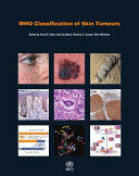 WHO CLASSIFICATION OF SKIN TUMOURS. 4TH EDITION