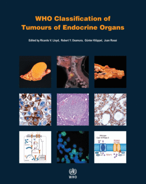 WHO CLASSIFICATION OF TUMOURS OF ENDOCRINE ORGANS. 4TH EDITION, VOLUME 10