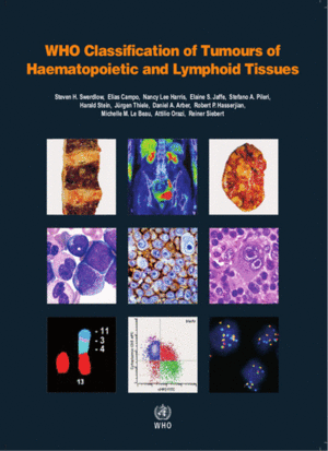 WHO CLASSIFICATION OF TUMOURS OF HAEMATOPOIETIC AND LYMPHOID TISSUES, REVISED 4TH EDITION