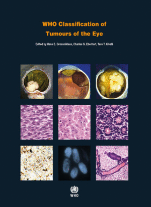 WHO CLASSIFICATION OF TUMOURS OF THE EYE. 4TH EDITION