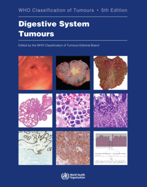 WHO CLASSIFICATION OF TUMOURS. DIGESTIVE SYSTEM TUMOURS. 5TH EDITION
