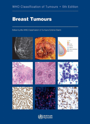 WHO CLASSIFICATION OF BREAST TUMOURS. VOLUME 2.  5TH EDITION