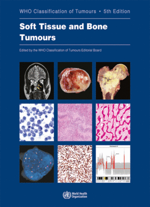 WHO. SOFT TISSUE AND BONE TUMOURS, WHO CLASSIFICATION OF TUMOURS. 5TH EDITION. (WHO CLASSIFICATION OF TUMOURS, VOL. 3)