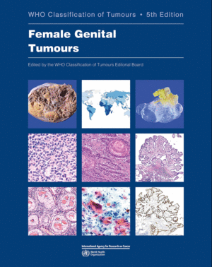 WHO CLASSIFICATION OF TUMOURS: FEMALE GENITAL TUMOURS. 5TH EDITION. VOLUME 4