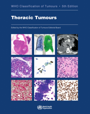 WHO CLASSIFICATION OF TUMOURS. THORACIC TUMOURS (WHO CLASSIFICATION OF TUMOURS, VOL. 5). 5TH EDITION
