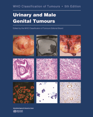 WHO CLASSIFICATION OF TUMOURS: URINARY AND MALE GENITAL TUMOURS (WHO CLASSIFICATION OF TUMOURS, 5TH EDITION)