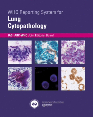 WHO REPORTING SYSTEM FOR LUNG CYTOPATHOLOGY (IAC-IARC-WHO CYTOPATHOLOGY REPORTING SYSTEMS, VOL. 1)