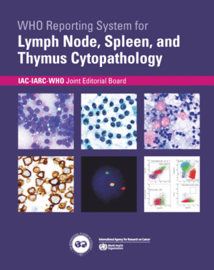 WHO REPORTING SYSTEM FOR LYMPH NODE, SPLEEN, AND THYMUS CYTOPATHOLOGY