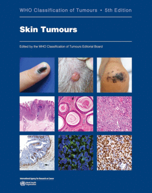 WHO CLASSIFICATION OF TUMOURS. SKIN TUMOURS.  5TH EDITION