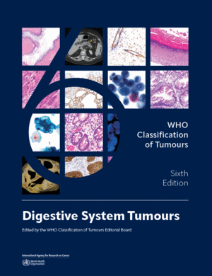 WHO CLASSIFICATION OF TUMOURS. DIGESTIVE SYSTEM TUMOURS. 6TH EDITION
