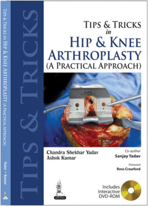 TIPS AND TRICKS IN HIP AND KNEE ARTHROPLASTY (A PRACTICAL APPROACH) + DVD-ROM