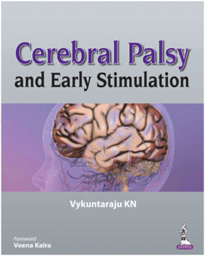 CEREBRAL PALSY AND EARLY STIMULATION