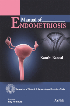 MANUAL OF ENDOMETRIOSIS