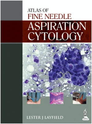ATLAS OF FINE NEEDLE ASPIRATION CYTOLOGY