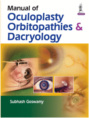 MANUAL OF OCULOPLASTY, ORBITOPATHIES AND DACRYOLOGY