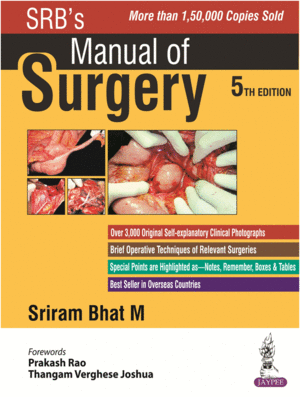 SRB'S MANUAL OF SURGERY. 5TH EDITION