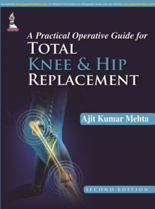 A PRACTICAL OPERATIVE GUIDE FOR TOTAL KNEE AND HIP REPLACEMENT + DVD-ROM