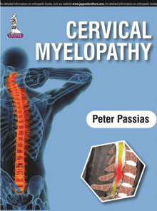CERVICAL MYELOPATHY