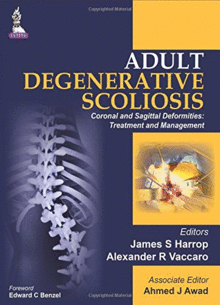 ADULT DEGENERATIVE SCOLIOSIS