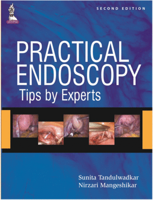PRACTICAL ENDOSCOPY - TIPS BY EXPERTS. 2ND EDITION