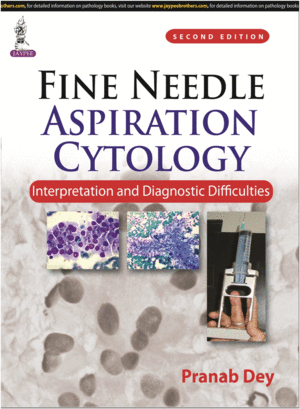 FINE NEEDLE ASPIRATION CYTOLOGY. INTERPRETATION AND DIAGNOSTIC DIFFICULTIES. 2ND EDITION