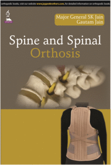 SPINE AND SPINAL ORTHOSIS