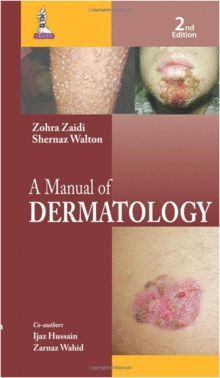 A MANUAL OF DERMATOLOGY