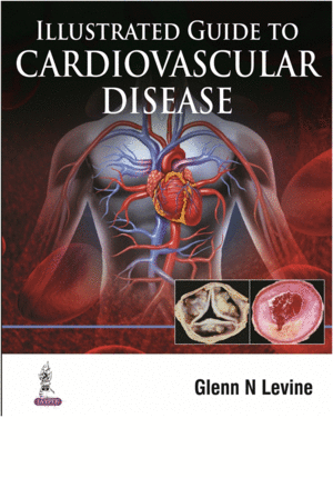 ILLUSTRATED GUIDE TO CARDIOVASCULAR DISEASE