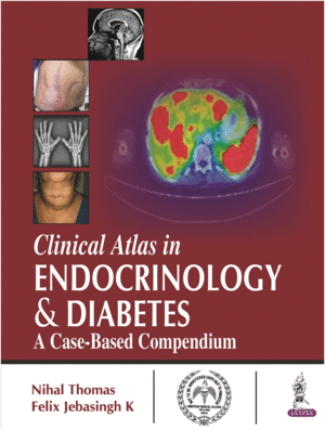 CLINICAL ATLAS IN ENDOCRINOLOGY AND DIABETES. A CASE-BASED COMPENDIUM