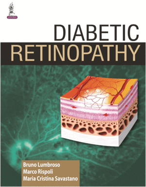 DIABETIC RETINOPATHY