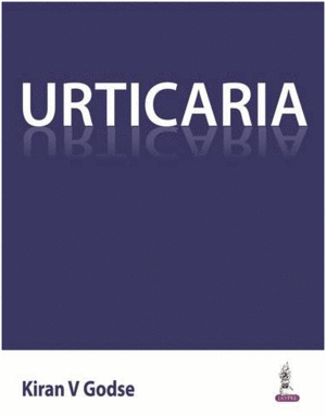 URTICARIA