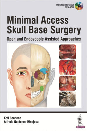 MINIMAL ACCESS SKULL BASE SURGERY. OPEN AND ENDOSCOPIC ASSISTED APPROACHES. INCLUDES DVD-ROM