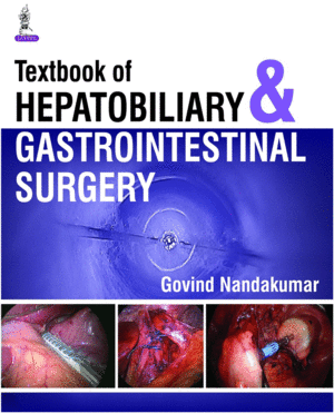 TEXTBOOK OF HEPATOBILIARY AND GASTROINTESTINAL SURGERY