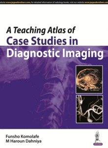 A TEACHING ATLAS OF CASE STUDIES IN DIAGNOSTIC IMAGING