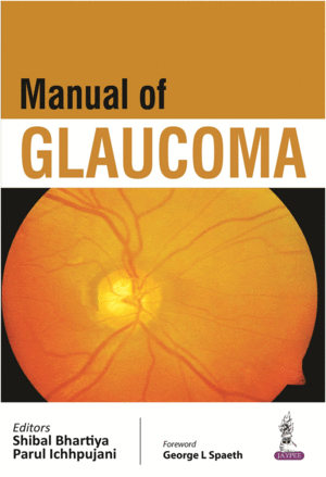 MANUAL OF GLAUCOMA