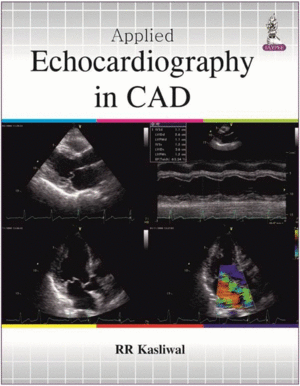 APPLIED ECHOCARDIOGRAPHY IN CAD