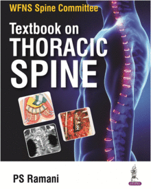 WFNS SPINE COMMITTEE TEXTBOOK ON THORACIC SPINE