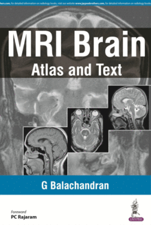MRI BRAIN: A MINI ATLAS AND TEXT
