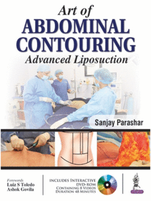 ART OF ABDOMINAL CONTOURING. ADVANCED LIPOSUCTION + DVD
