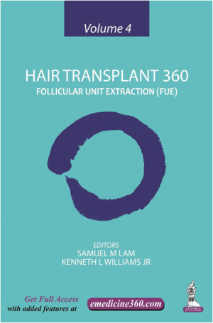 HAIR TRANSPLANT 360: VOLUME 4  FOLLICULAR UNIT EXTRACTION