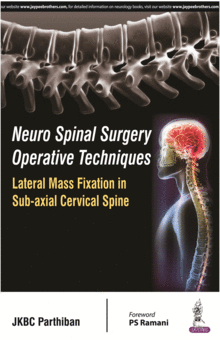 NEURO SPINAL SURGERY OPERATIVE TECHNIQUES